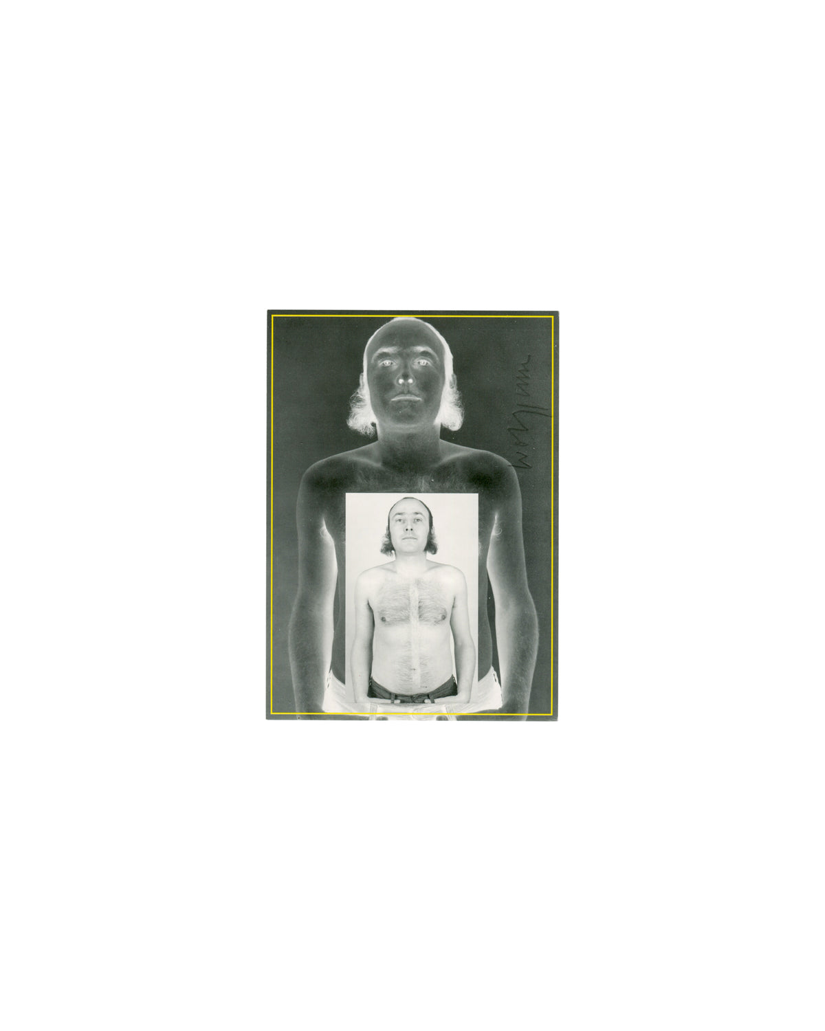 Wolf Kahlen, Selbstversuch II, 1969, artist postcard recto, inverted self-portrait with positive print overlay, ink signature